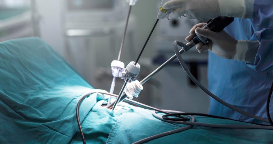 Laparoscopic Surgery