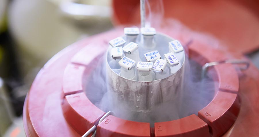 Semen Freezing