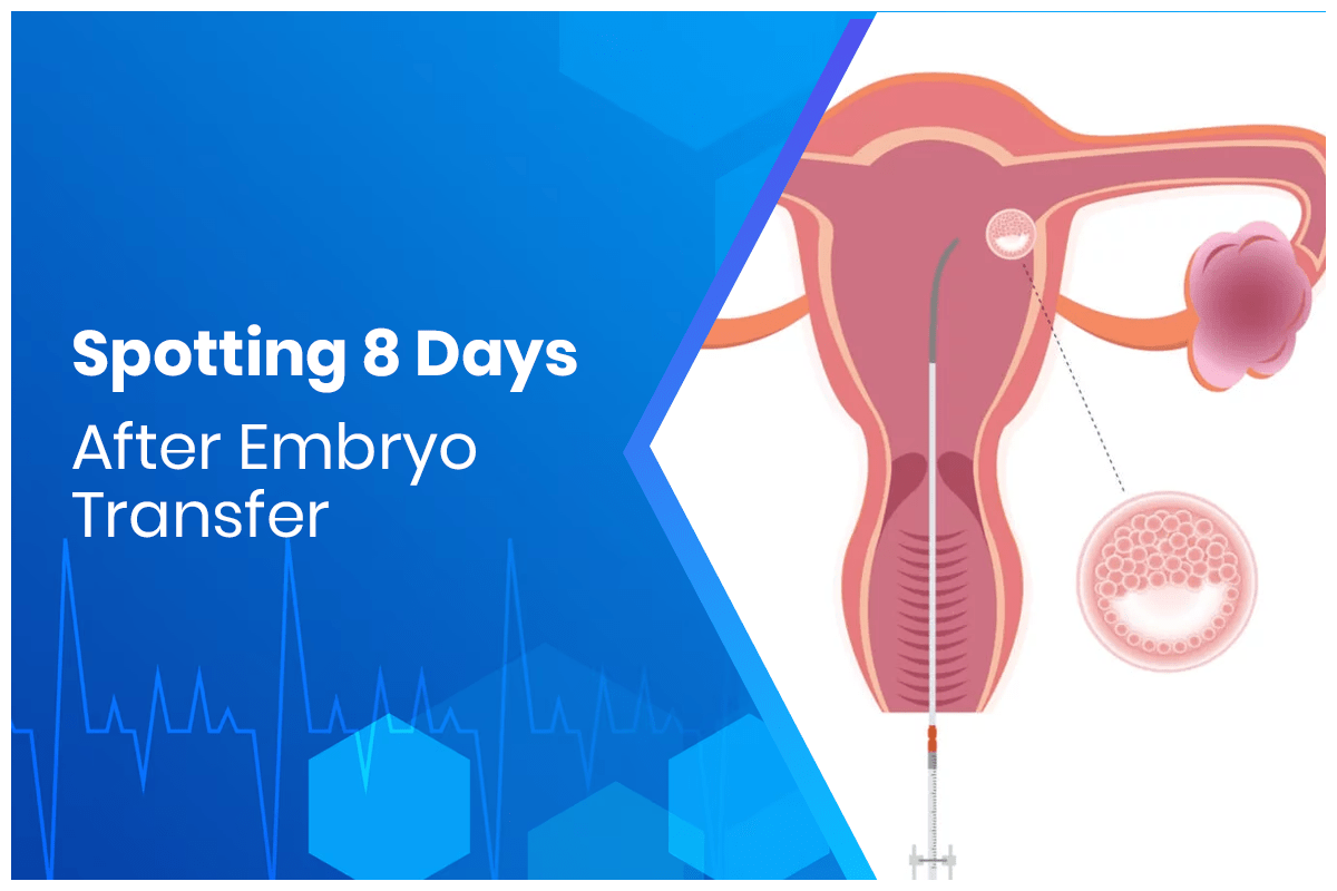 Spotting 8 Days After Embryo Transfer | Bloom IVF