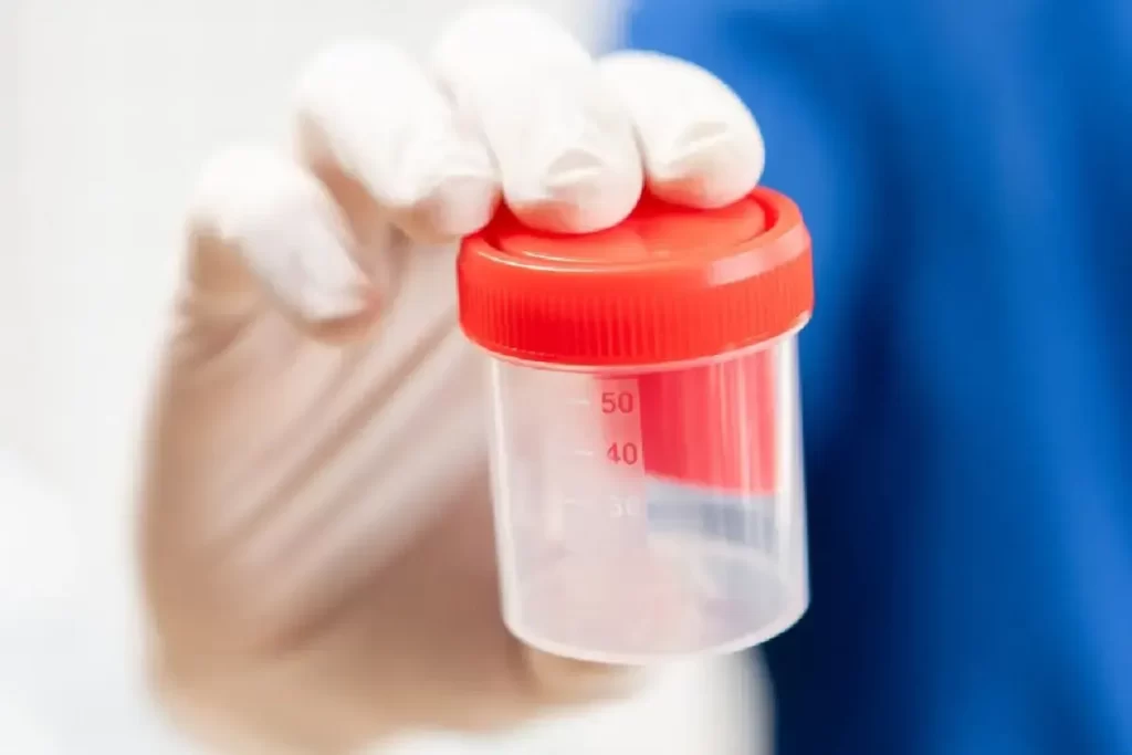 Diagnosis of Teratozoospermia image