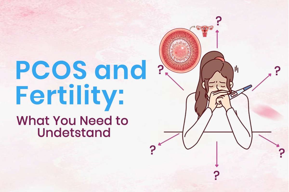 PCOS and Fertility: What You Need to Understand blog featured image