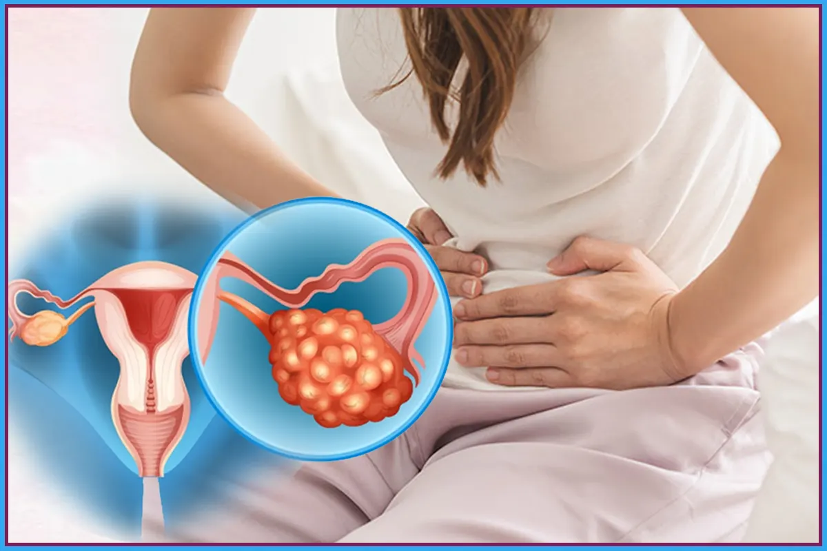 PCOD Explained Symptoms, Causes, Diagnosis & Treatment Options Blog Feature Image