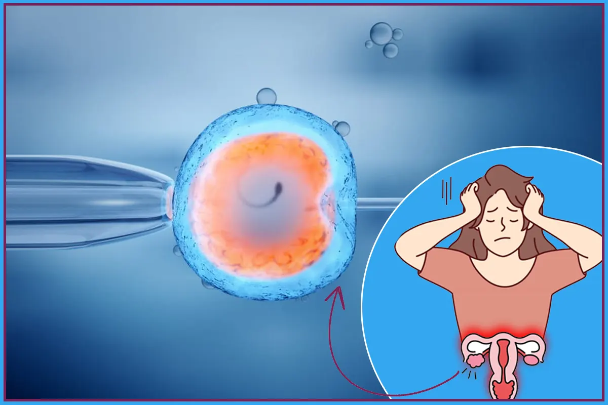 Is IVF Necessary for PCOD When You Need It and When You Don't? Blog featured image